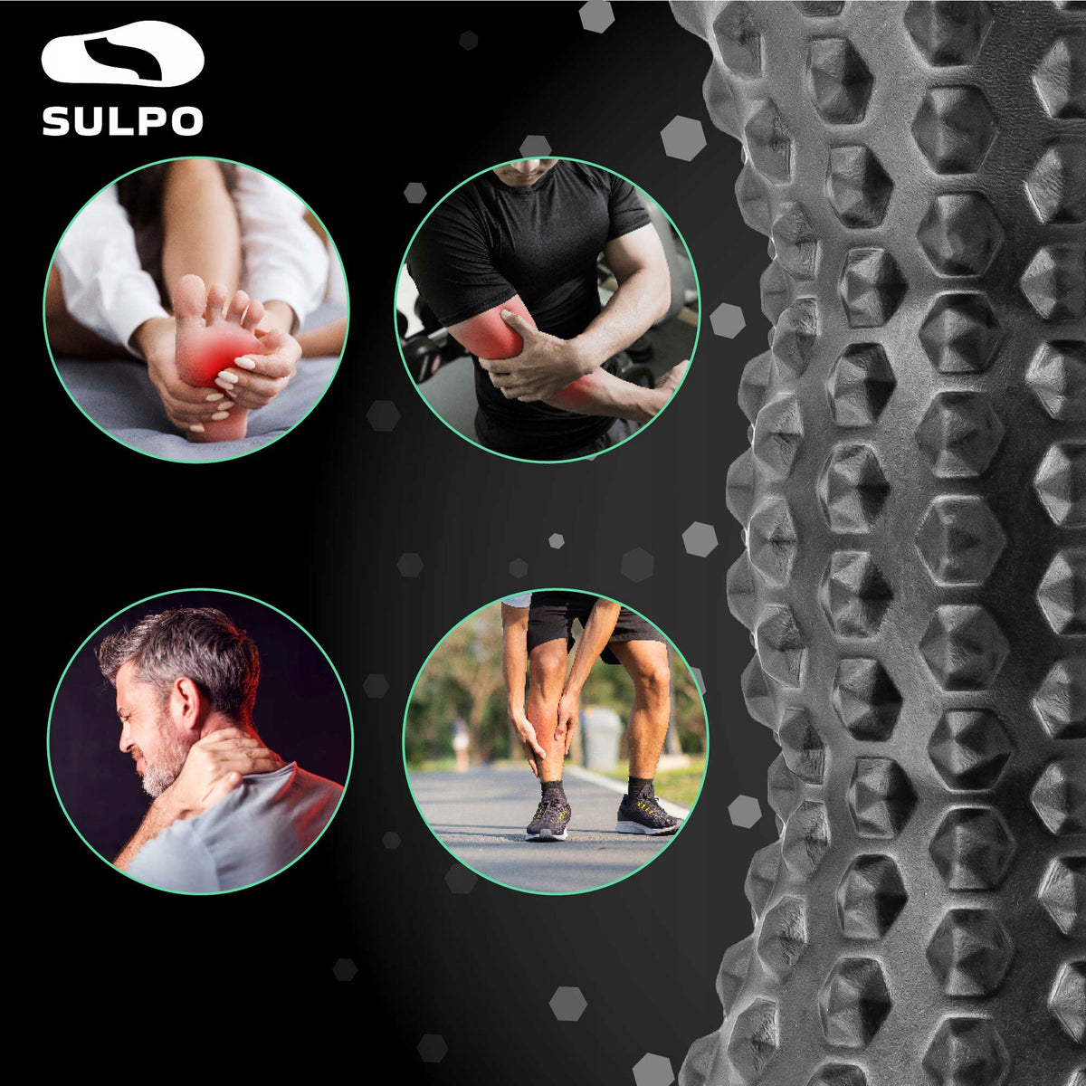 Volelis „Sulpo“ – nuotrauka 7
